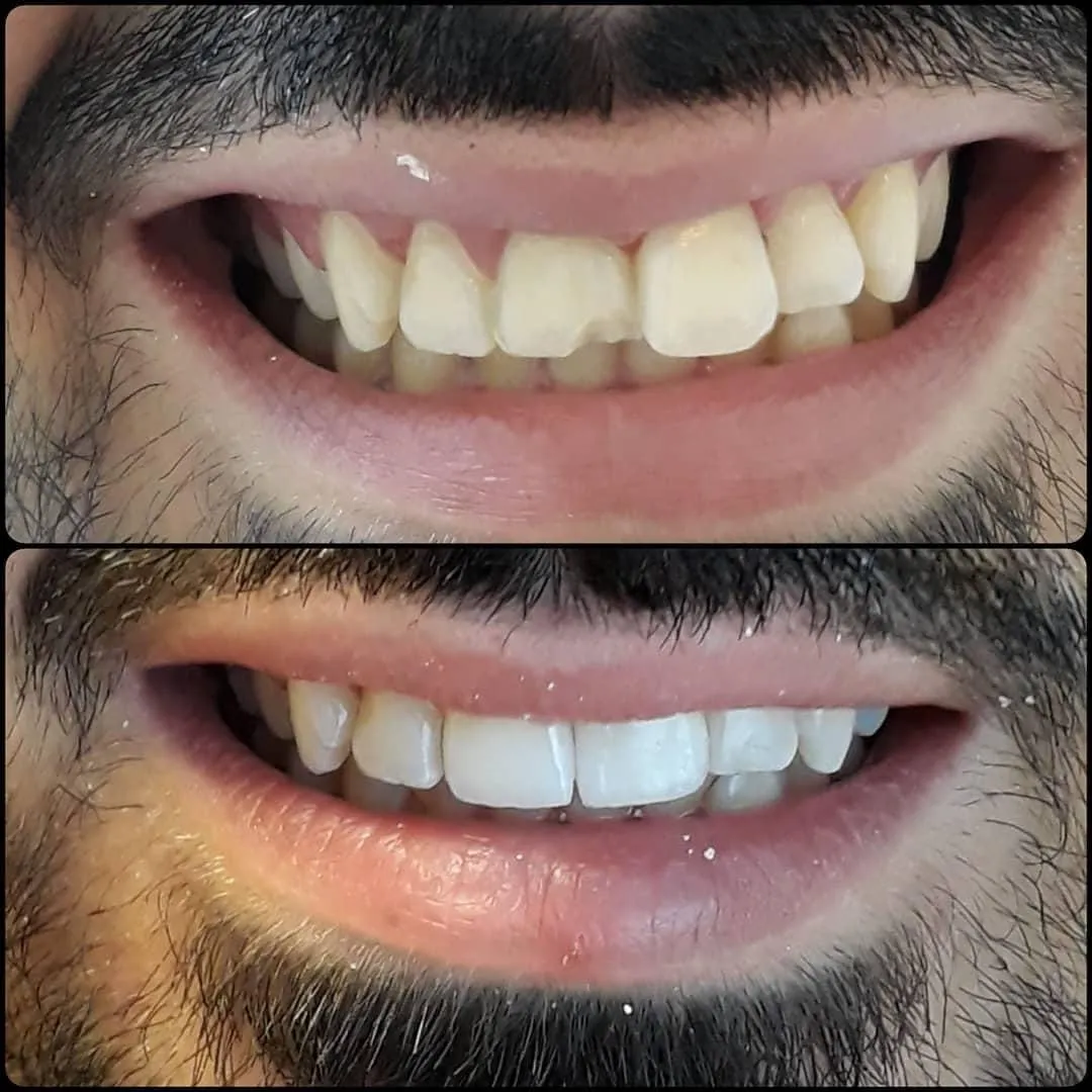 WhatsApp Image 2026-02-10 at 17.35.11